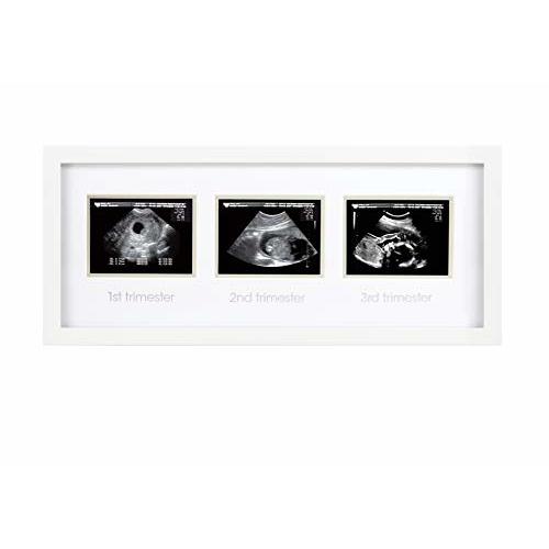 Pearhead Sonogram Progression Frame - Trimester by Trimester Pregnancy Milestone Keepsake, Gender-Neutral Nursery Decor, Displays 1st, 2nd & 3rd Trimester Ultrasound Photos, White