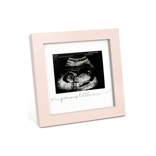 Solo Baby Sonogram Frame