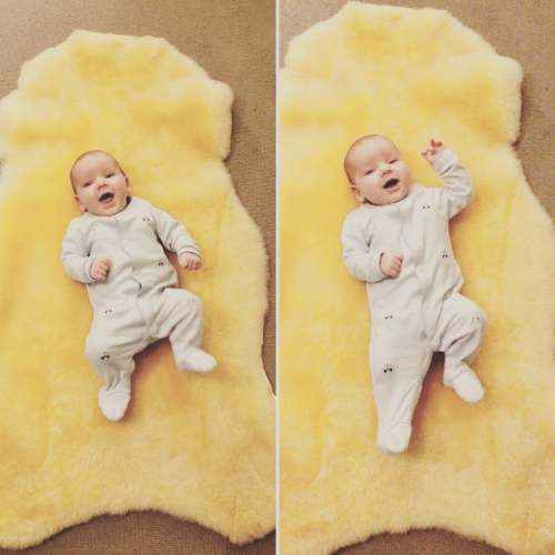 Medical Grade Sheepskin | Baby Sheepskin | Hypoallergenic Relugan Shorn