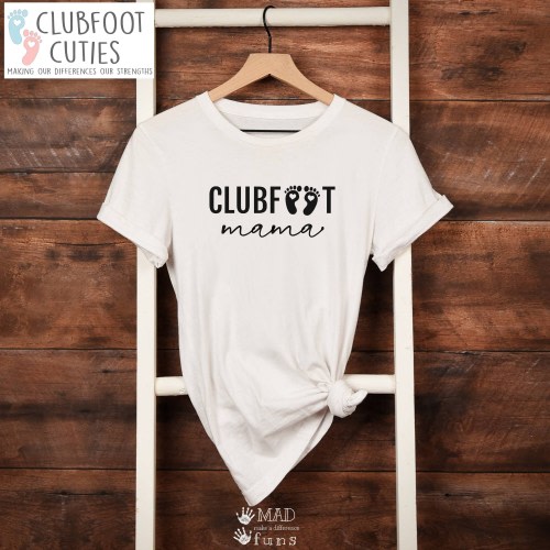 Clubfoot Mama Shirt | Clubfoot Dad | Clubfoot Cuties T-Shirt| Clubfoot Baby Gift | Gray or White Adult Shirt | Gift For Mom Dad | Footprints