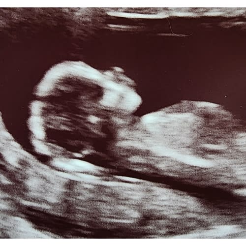 Cash Fund - towards leftover items needed and doula