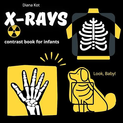 X-RAYS, contrast book for infants | Rhyming verses: Black and white book, baby contrast book, Educational book for children ages 0-3, X-ray Paperback – March 7, 2024