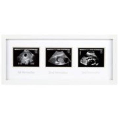 Pearhead Triple Sonogram Pregnancy Keepsake Picture Frame, Three Trimesters, White
