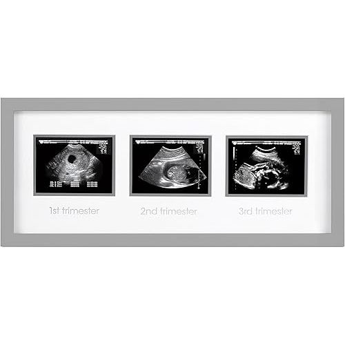 Pearhead Triple Sonogram Picture Frame, Pregnancy Keepsake Photo Frame, Gender-Neutral Baby Nursery Décor, Baby Accessory for New and Expecting Parents, Gray