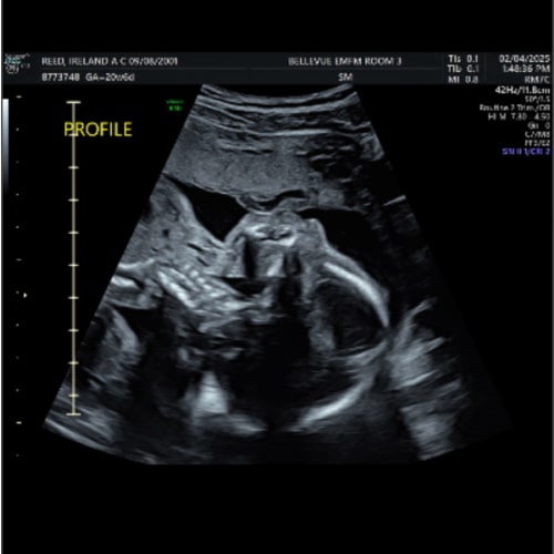 Diapers Fund