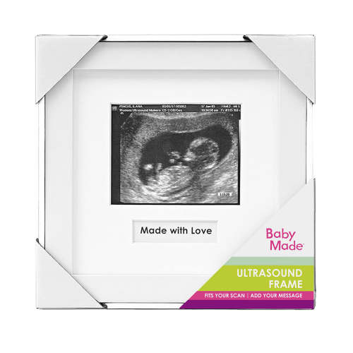 Ultrasound Scan Frame