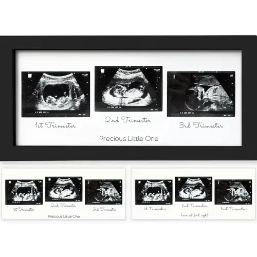 KeaBabies Baby Sonogram Picture Frames - Trio Ultrasound Picture Frames, First Time Mom Gift, Cute Pregnancy Reveal Photo Frame, Baby Gender Reveal Gift,Newborn Nursery Decor(Onyx Black)