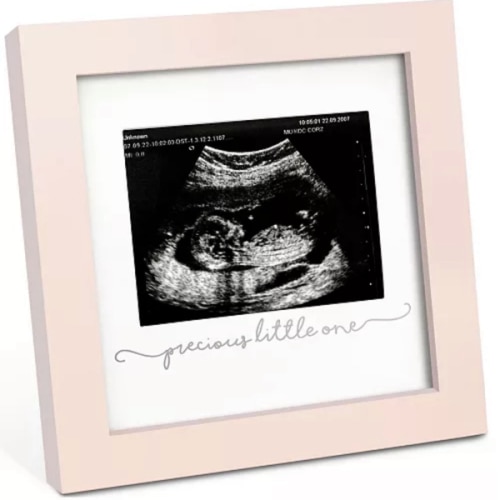 Solo Baby Sonogram Picture Frame, Modern Ultrasound Picture Frames, Pregnancy Announcements Sonogram Frame