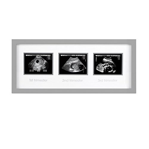 Pearhead Triple Sonogram Pregnancy Keepsake Frame, Ultrasound Growth Milestone Frame, Gray