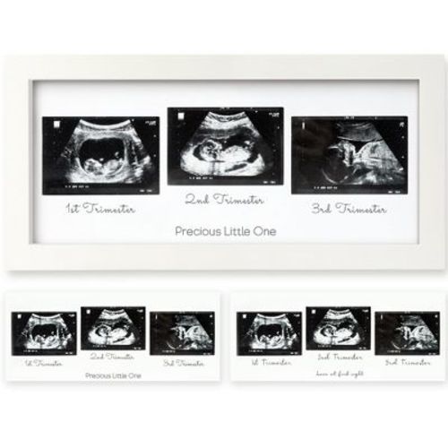 KeaBabies Trio Baby Sonogram Picture Frame, Baby Ultrasound Picture Frames for Baby Nursery, Mom to Be Gifts (Alpine White)