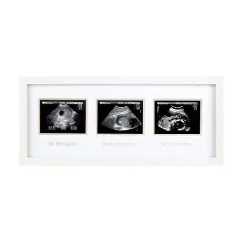 Pearhead Sonogram Progression Frame - Trimester by Trimester Pregnancy Milestone Keepsake, Gender-Neutral Nursery Decor, Displays 1st, 2nd & 3rd Trimester Ultrasound Photos, White