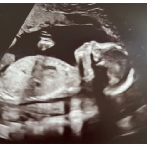 Cash Fund for Diapers & Boy Clothes