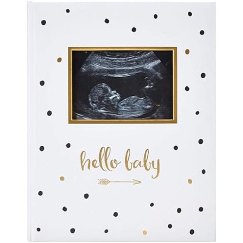 Pearhead Hello Baby First 5 Years Memory Book, Gender-Neutral Baby Keepsake for New and Expectant Parents, Pregnancy And Milestone Journal, Modern Minimalist Black and Gold Polka Dot