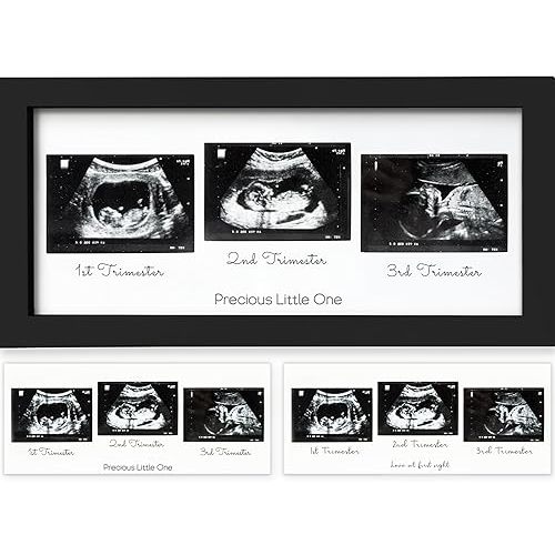 KeaBabies Baby Sonogram Picture Frames - Trio Ultrasound Picture Frame, First Time Mom Gift, Cute Pregnancy Reveal Photo Frame, Baby Gender Reveal & Mother's Day, Newborn Nursery Decor (Onyx Black)