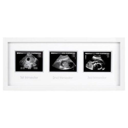 Trimester Sonogram Frame - White