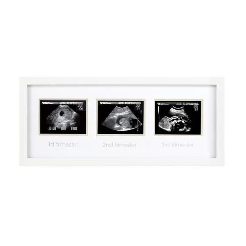 Pearhead Sonogram Progression Frame - Trimester by Trimester Pregnancy Milestone Keepsake, Gender-Neutral Nursery Decor, Displays 1st, 2nd & 3rd Trimester Ultrasound Photos, White