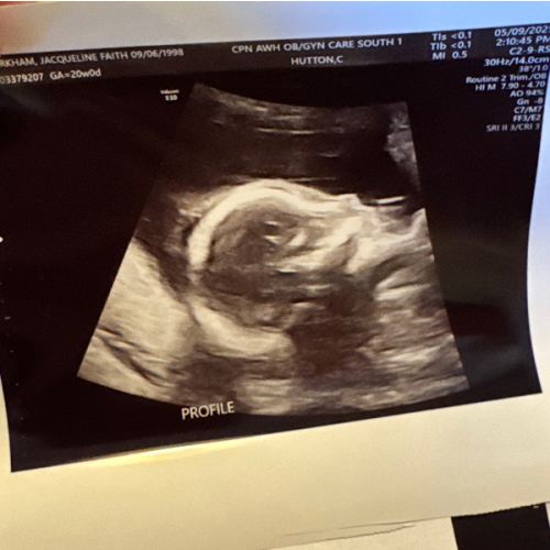 Maternity Leave Fund