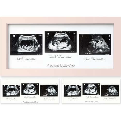 Sonogram Picture Frame - Trio Ultrasound Picture Frames For Mom To Be Gift - Baby Ultrasound frame - Pregnancy Announcements Sonogram frame - Baby Nursery Decor, Pregnant Mom Gifts (Petal Pink)