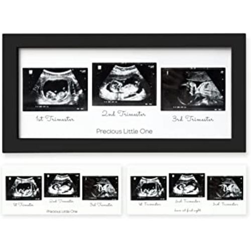 Sonogram Picture Frame - Trio Ultrasound Picture Frames For Mom To Be Gift - Baby Ultrasound frame - Pregnancy Announcements Sonogram frame - Baby Nursery Decor, Pregnant Mom Gifts (Onyx Black)