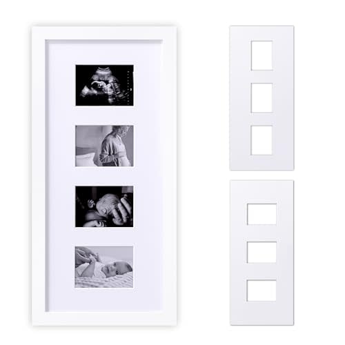 eletecpro Ultrasound Picture Frame, Baby Sonogram Picture Frame Display 3 or 4 Photos, Vertical or Horizontal, Idea Gift for Expecting Parents, Pregnant, Gender Reveal Party, Baby Nursery Decor, White