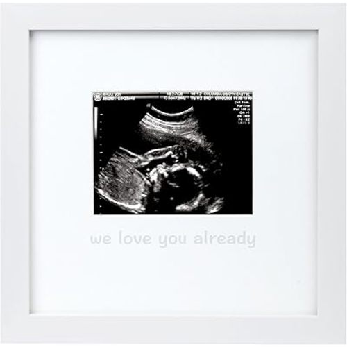 tiny ideas We Love You Already Sonogram Sentiment Frame, Baby Announcement, Gender Neutral Ultrasound Keepsake, Ideal Pregnancy Gift, Baby Shower and Nursery Decor, 4”x5” Photo Insert, White