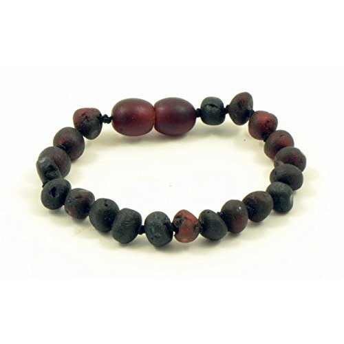 Amber Teething Bracelet, Amber teething Anklet for Baby, Genuine Raw Baltic Amber Bead Anklet, Unpolished Amber, Anti-Inflammatory, Hand-Made, Knotted, Various Sizes (Raw Cherry, 6.3 in (16cm))