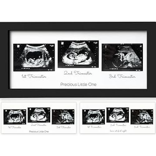 Sonogram Picture Frame - Trio Ultrasound Picture Frames For Mom To Be Gift - Baby Ultrasound frame - Pregnancy Announcements Sonogram frame - Baby Nursery Decor, Pregnant Mom Gifts (Onyx Black)