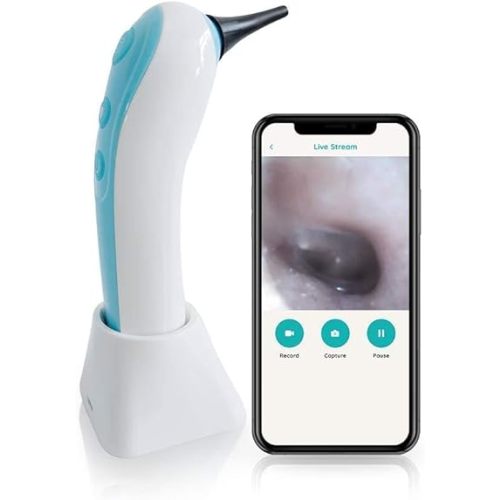 Wireless Otoscope Ear Camera - Remmie Dolphin FDA Registered Wireless Ear Scope Otoscope with Light iPhone, Android and Camera for ENT Throat Nose and Skin, Recommended by Pediatricians for Kids