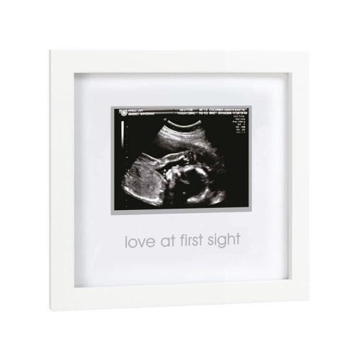 Sonogram Frame, Love At First Sight