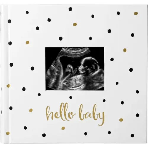 Pearhead Hello Baby Photo Album, Keepsake Book for New and Expecting Parents, Gender-Neutral Baby Accessory, Ideal Gift for Baby Shower, Holds 200 Pictures, Black and Gold Polka Dot