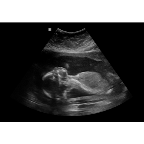 Maternity/Baby photoshoot!