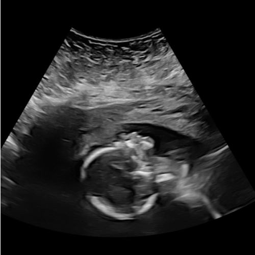 Baby Speece-Comer | Walmart.com