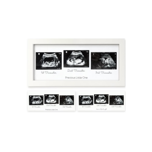 Trio Baby Sonogram Frame
