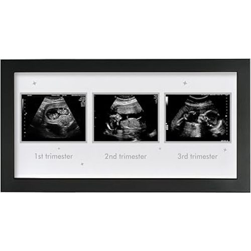 Ultrasound Picture Frame - Triple Sonogram Frame for Mom to Be | Pregnancy Photo Album Decor | Baby Nursery Essentials & Gender Reveal Gifts | First Trimester Keepsake & Pregnancy Must Haves, Black1