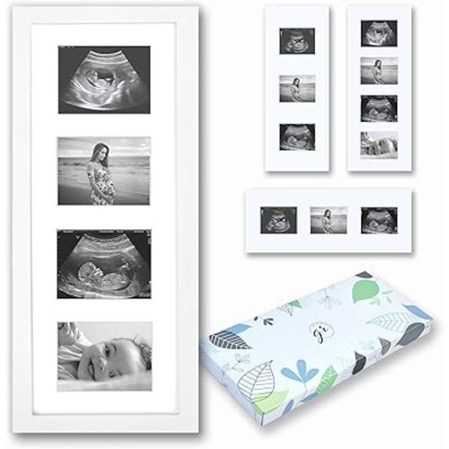 Baby Sonogram Picture Frame | 3 in 1 Layout Set, White | Ultrasound Frame | Vertical or Horizontal | Baby Ultrasound Picture Frame | Ultrasound Picture Frames | Sonogram Frame | Ultrasound Photo Frame | Ultrasound Frames for Baby
