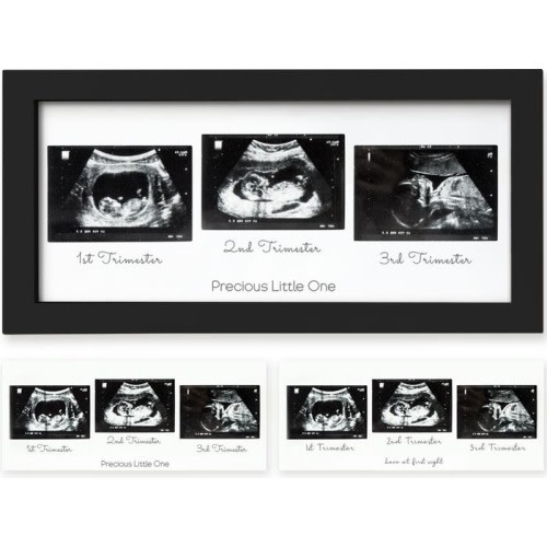 KeaBabies Trio Baby Sonogram Frame, Onyx Black