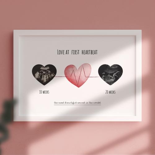 Baby Scan Photo | Gift for Her | First time Mum | Mother's Day | Baby Scan Personalised | Baby Heartbeat | Baby Memory Box