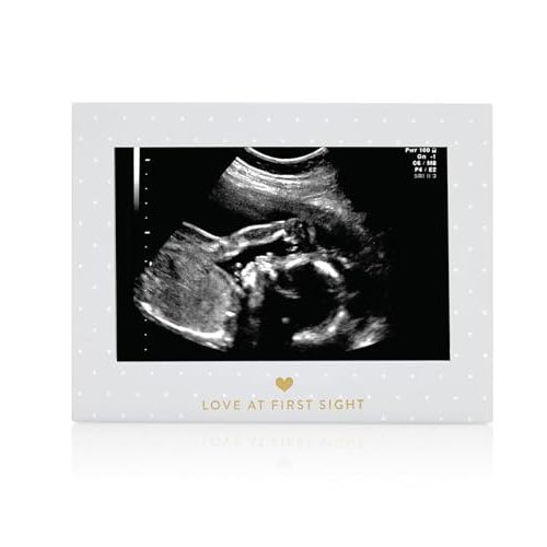 Pearhead Little Blossoms Love At First Sight Sonogram Picture Frame, Ultraound Pregnancy Keepsake, Gender-Neutral Nursery Décor For Baby Girl or Baby Boy, Polka Dot, 6.94x5.25x.75 Inch (Pack of 1)