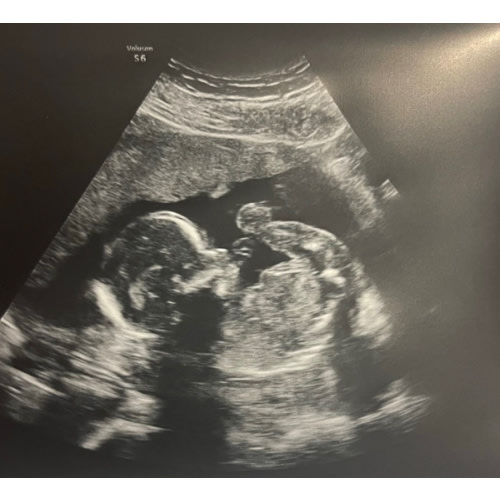 Baby Robinson Cash Fund