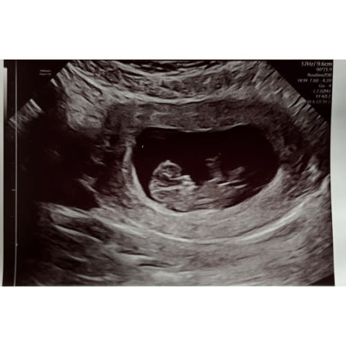 Baby Items Fund
