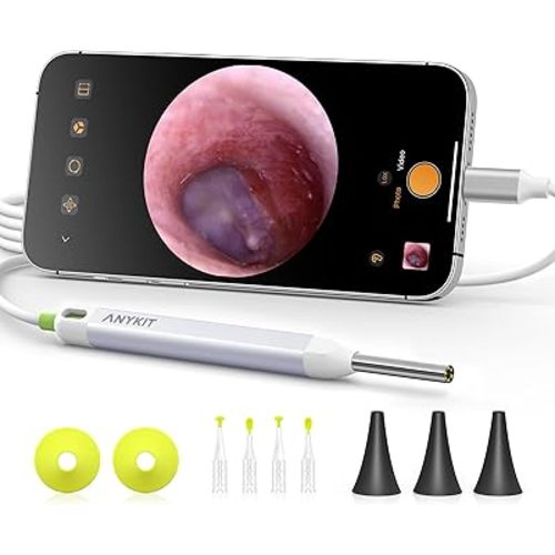 Anykit Digital Otoscope with Gyroscope, HD Ultra Clear View Ear Camera with Ear Wax Removal Tools, Video Ear Scope Otoscope with Light, Compatible with Android, iPhone 15 (White)