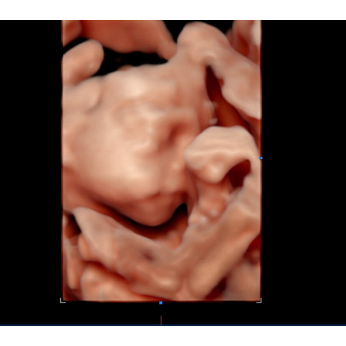 Parental Leave Fund - Unfortunately, due to the lack of paid maternity leave offered by her employer, Mom will need to take several weeks off from work without pay following baby’s arrival. Any contribution to this parental leave fund would mean so much.