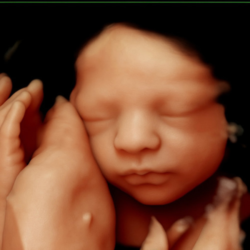 Parental Leave Fund