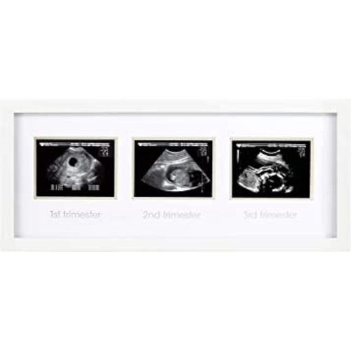 Pearhead Sonogram Progression Frame - Trimester by Trimester Pregnancy Milestone Keepsake, Gender-Neutral Nursery Decor, Displays 1st, 2nd & 3rd Trimester Ultrasound Photos, White