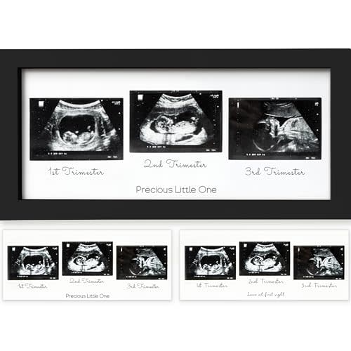 KeaBabies Baby Sonogram Picture Frames - Trio Ultrasound Picture Frames, First Time Mom Gift, Cute Pregnancy Reveal Photo Frame, Baby Gender Reveal Gift, First Mother's Day (Onyx Black)