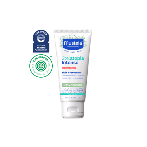 Stelatopia intense eczema relief