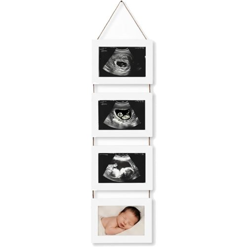 4-in-1 Sonogram Picture Frame, Display Pregnancy Keepsake Album for Pregnancy Announcements, Gender Reveal, and Newborn Photos, Perfect Gender-Neutral Nursery Decor, First Time Mom Gift, White