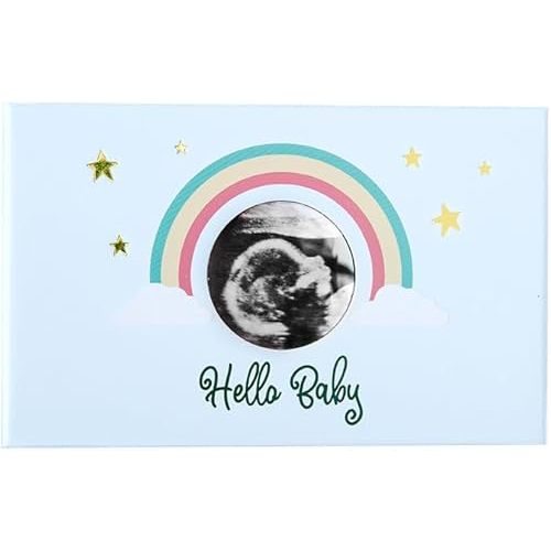 MBHB Ultrasound & Pregnancy Photo Album, 4x6" Picture Album Holds 100 Baby Memories, Perfect Keepsake Scrapbook, Durable Large Design Pictures, Ideal Baby Albums Scrap Book for Photos, Blue