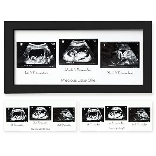 Sonogram Picture Frame - Trio Ultrasound Picture Frames For Mom To Be Gift - Baby Ultrasound frame - Pregnancy Announcements Sonogram frame - Baby Nursery Decor, Pregnant Mom Gifts (Onyx Black)
