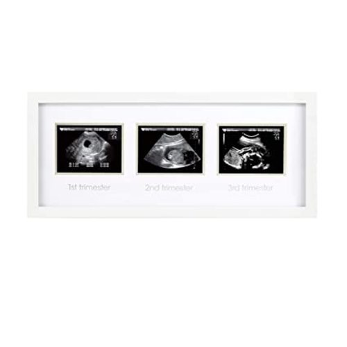 Pearhead Trimester Progression Sonogram Picture Frame, Pregnancy Milestone Keepsake Photo Frame, Sonogram Keepsake, Gender-Neutral Baby Nursery Décor - White